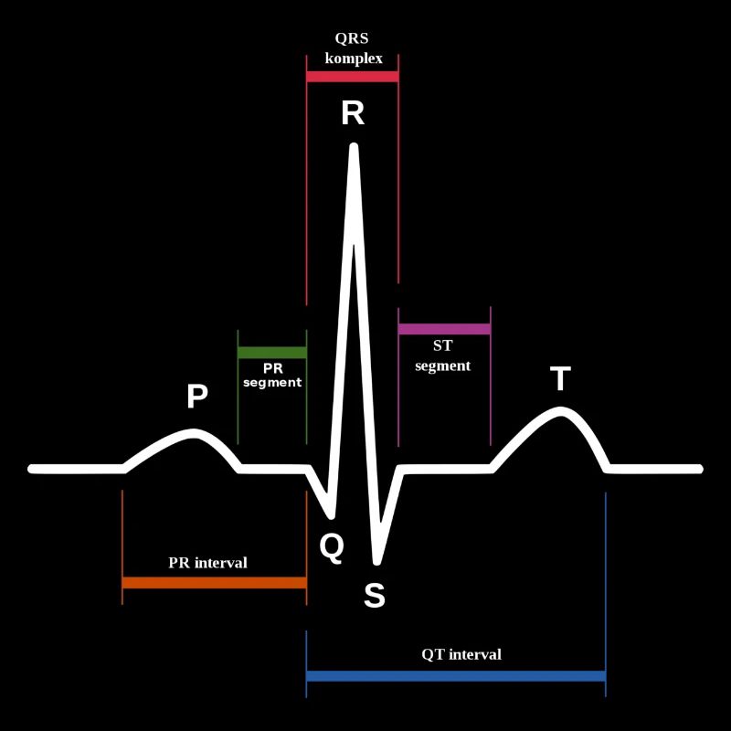 ecg heartbeat