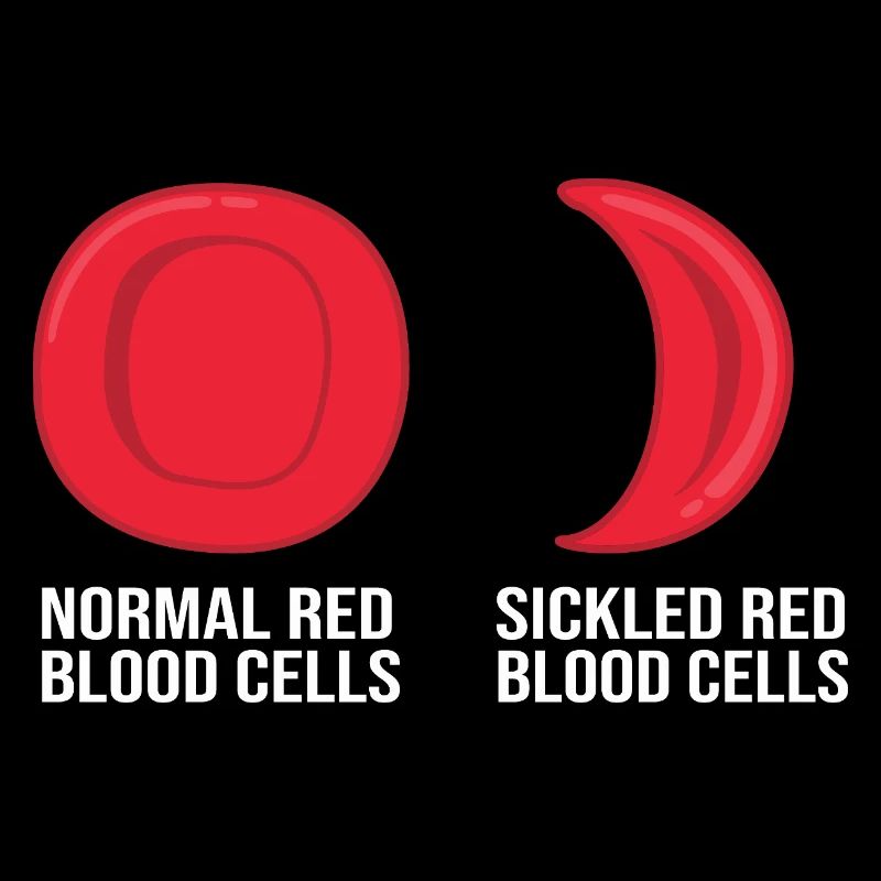 Sickle cell anemia
