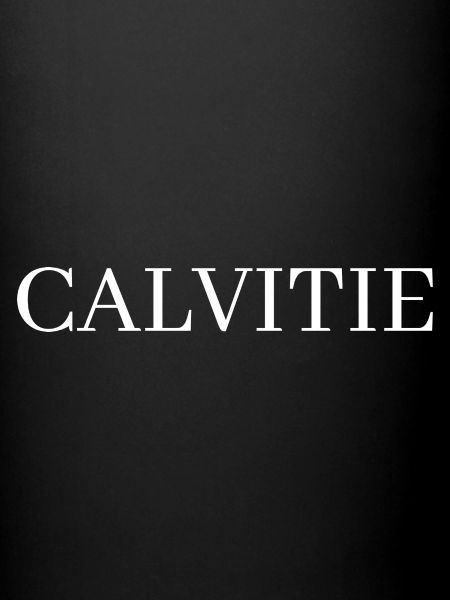 Calvitie