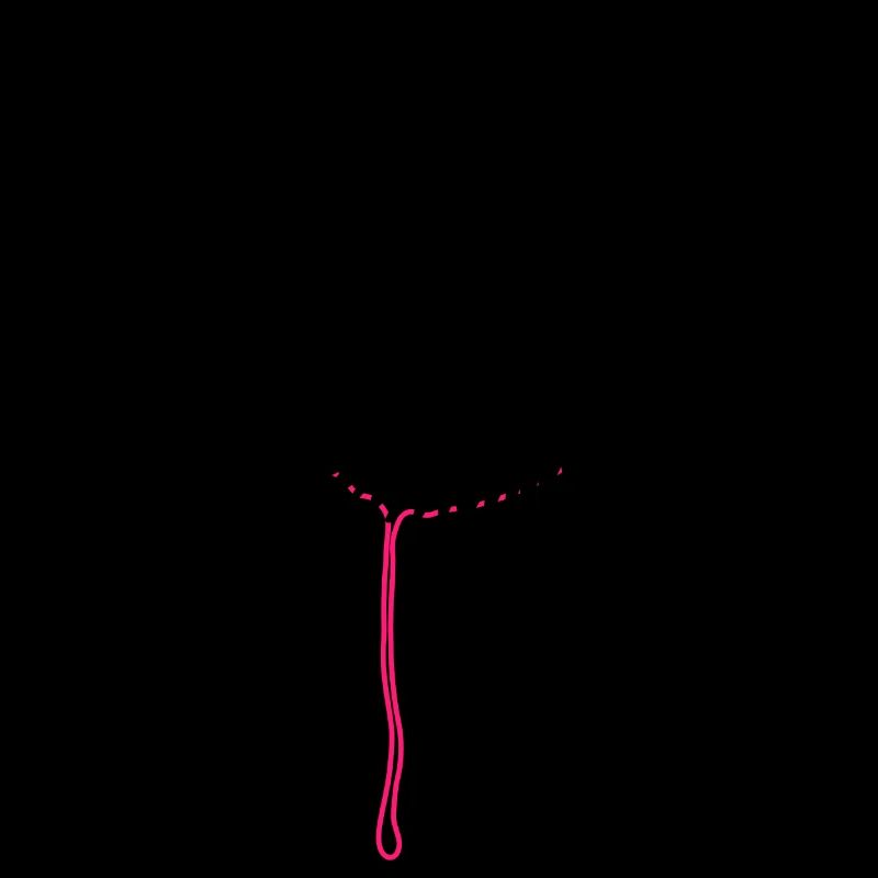 Zerreißen