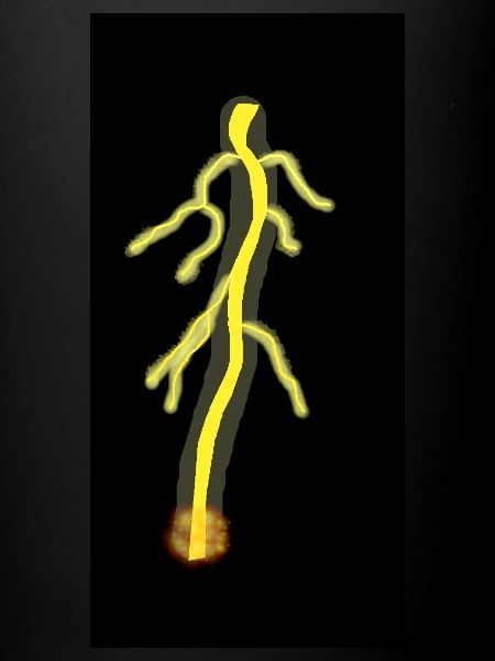 Foudre jaune