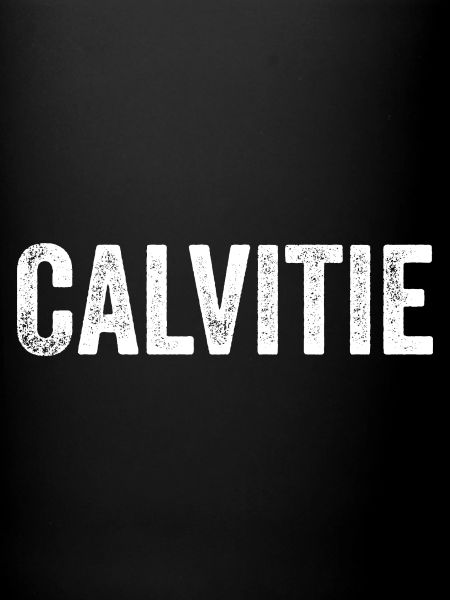 Calvitie