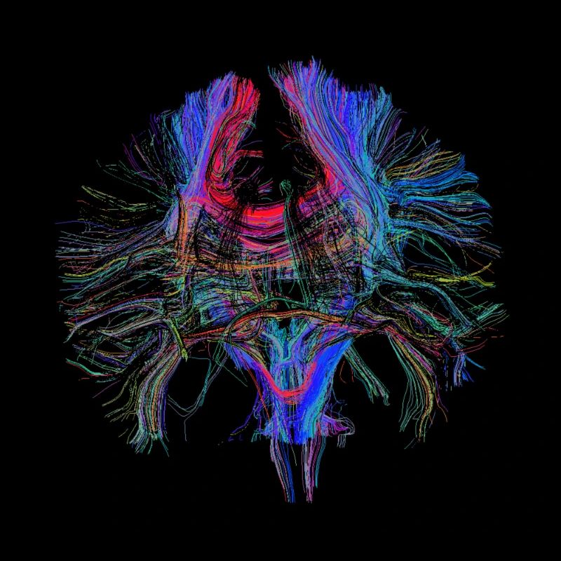 Brain and Tractography