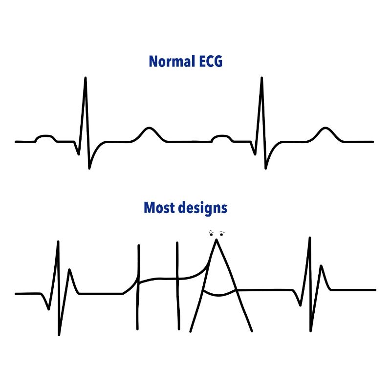 Électrocardiogramme (ECG) - Normal versus Hä?
