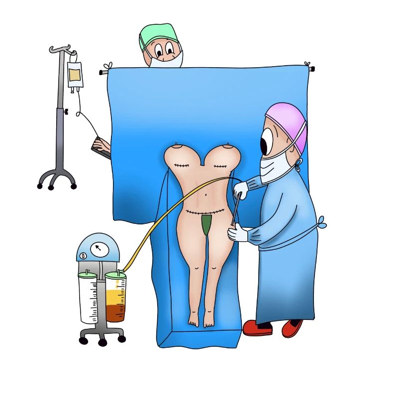 Plastic surgery