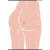 Podex "F" Illustration