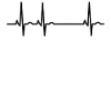 PERSONALIZABLE evolution ekg heartbeat herzschl