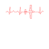 Aircraft ECG heartbeat