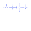 Aircraft ECG heartbeat