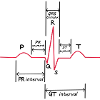 ECG