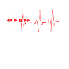 Rythme cardiaque