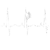 Climbing Heartbeat ECG - Climber Design