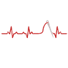 Heartbeats Sewer Heart Rate