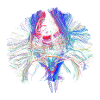 Brain and Tractography