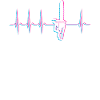 Herzschlag EKG Kettensäge
