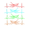 Hubschrauber Herzschlag