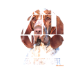NASSU Bracco