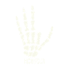 High Four - Finger Amputee - Amputation