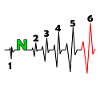 Motorcycle heartbeat