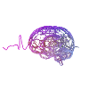 EEG Sharp Wave