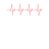 Climbing heartbeat