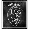 Heart Anatomy
