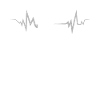 Jet Heartbeat ECG heart beat