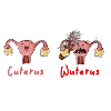 cuterus