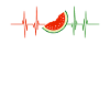 Pastèque