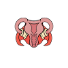 Hysterectomy Funny uterus Hysterectomy