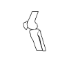 Knee replacement