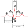 ECG v2