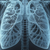 X-ray of the lungs