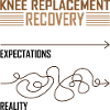 Knee Replacement Recovery