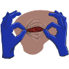 operation