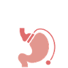 Banding mode on gastric banding