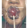 Lolli lippen Glitzer