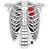 SKELETON