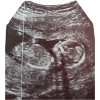 Babyloading... Please be patient! Ultrasound