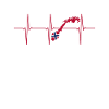Norway ECG Heartbeat