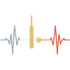 Cricket Palpitations ECG
