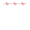 Pottery ECG Heartbeat