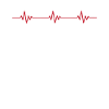 Pulsation ECG extraterrestre extraterrestre
