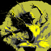 Neoexpressionistischer Tanz voller Farben
