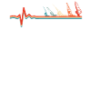 Windsurfing Windsurfer Ekg Heartbeat
