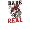 Ehlers Danlos Rare mais réel