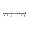 Braces orthodontist