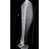 Leg Bone X-Ray