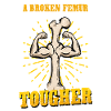 Leg fracture Broken thigh