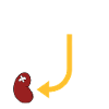 My New Kidney Is Down Here